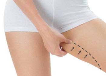 Giảm mỡ đùi nhanh chóng với 3 cách sau